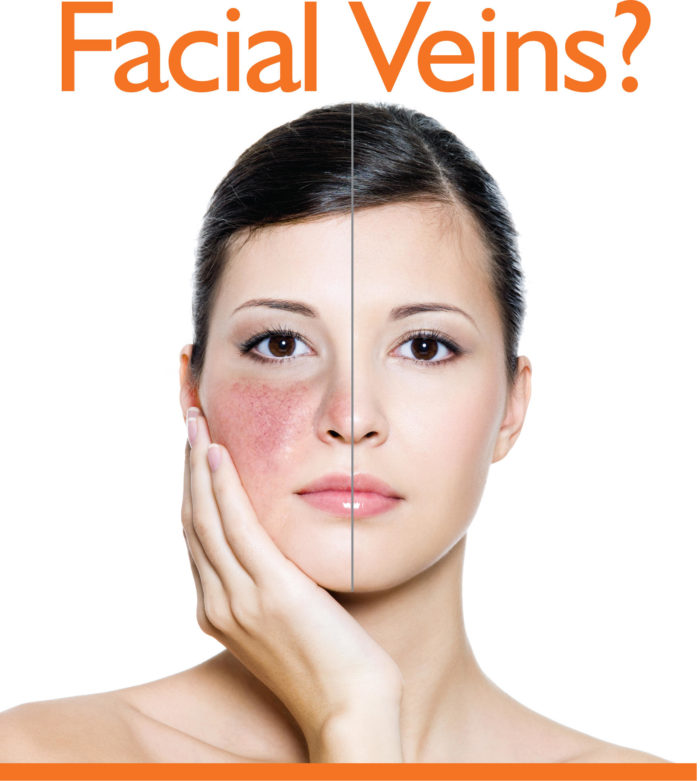 FacialVeins